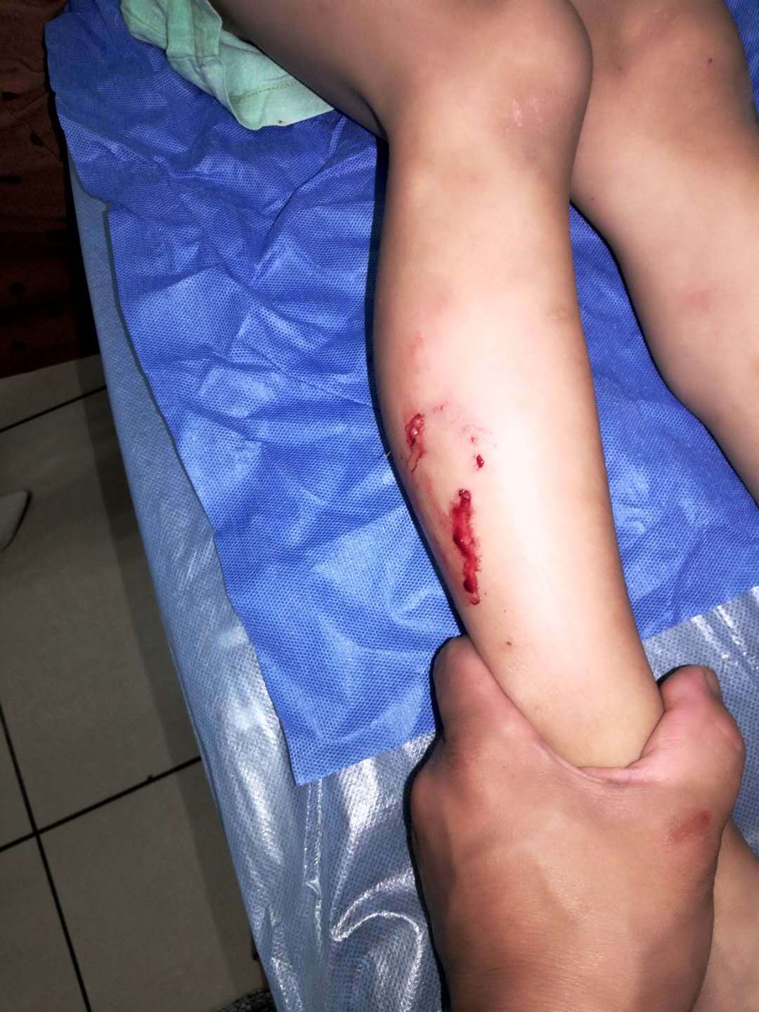 儿子被家中狗咬身亡这是一个非常悲痛的事件。如果您的儿子被家中的狗咬伤并因此丧生，您和其他家庭成员可能会感到非常震惊、悲痛和难过。在这种情况下，以下是一些建议